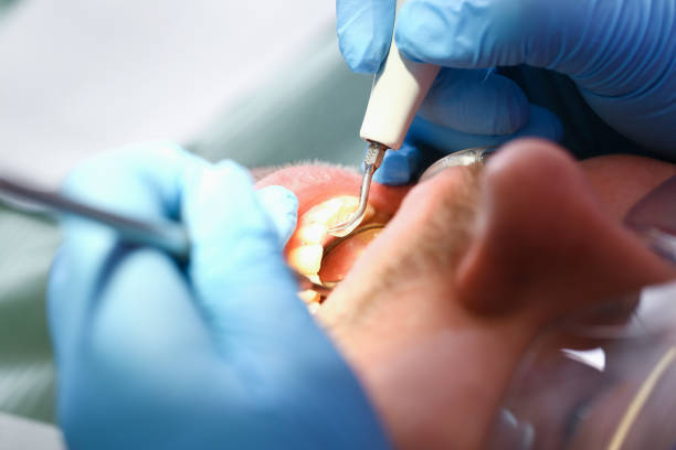 Best Emergency Broken Tooth Repair in Rogers, AR