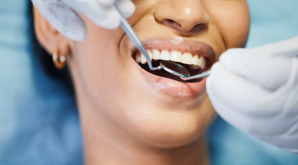 Best Emergency Root Canal Treatment in Rogers, AR