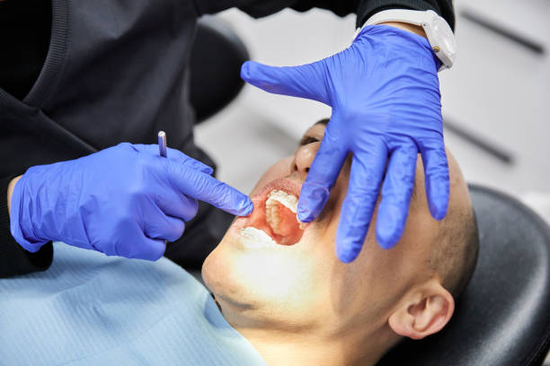Best Emergency Wisdom Teeth Removal in Rogers, AR